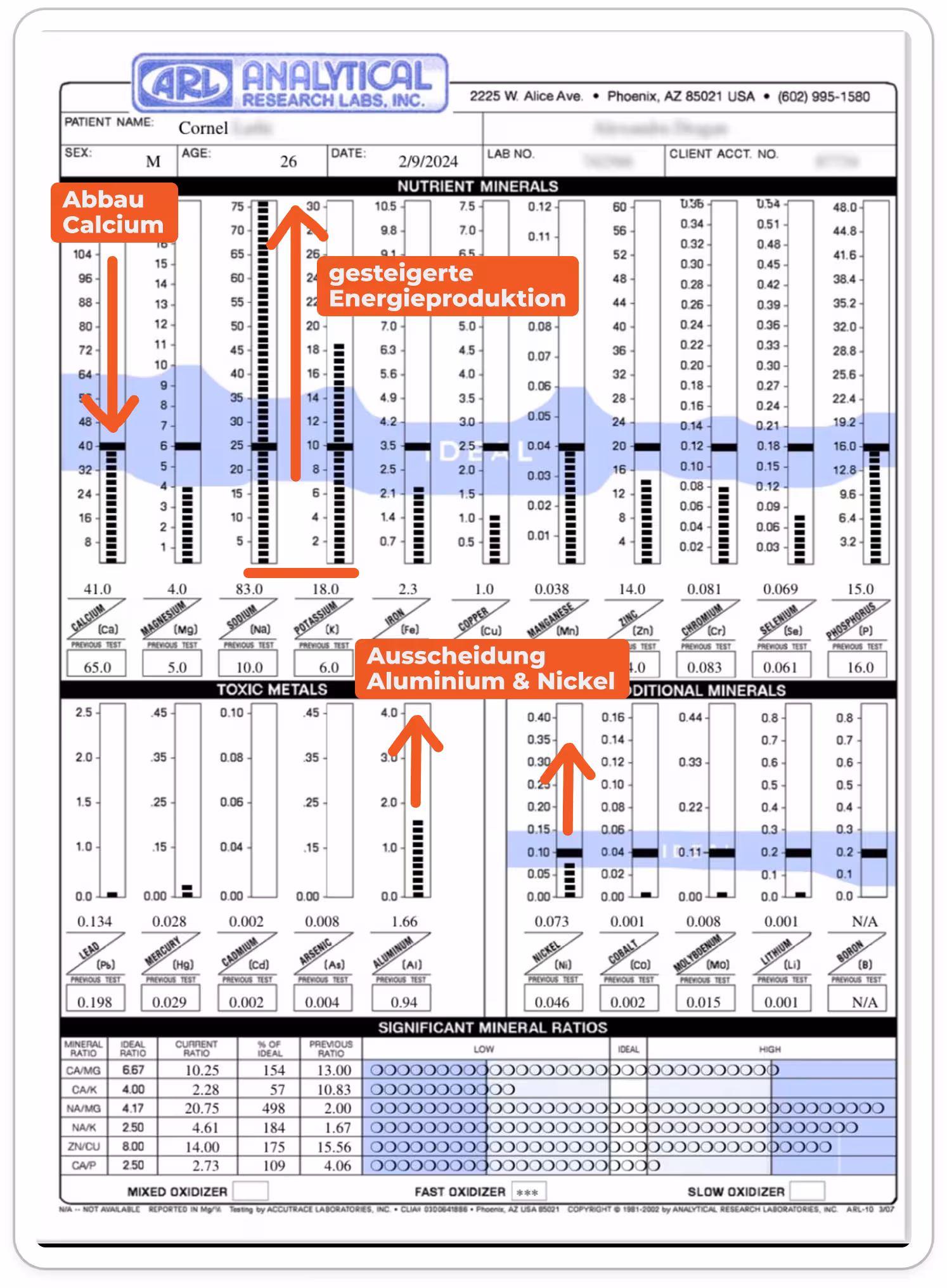 2. Haarmineralanalyse: Natriumwert um 830 Prozent gestiegen, normalisierter Calciumwert, beginnende Aluminium-Ausscheidung